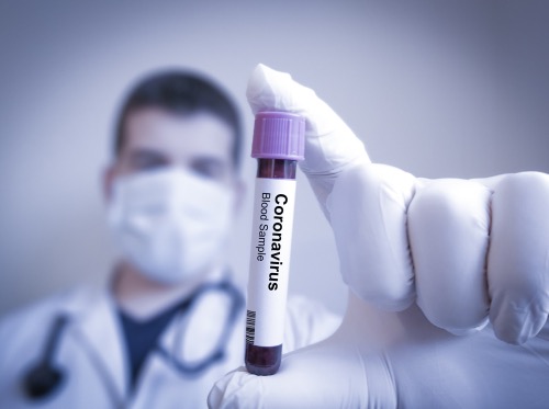 CoronaVirus_1625206747 CoronaVirus